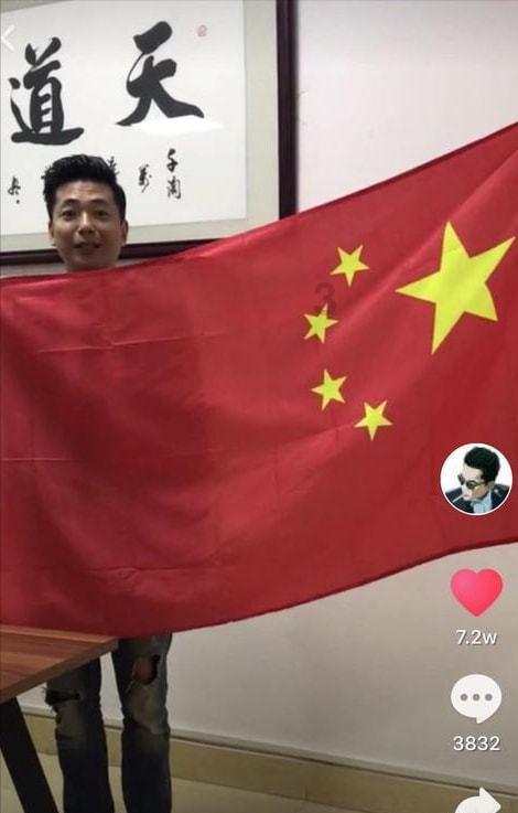 肝变硬了,头先知?头部若出现这5种情况,建议尽早检查